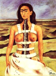 Frida Kahlo Accidente